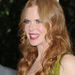 Nicole Kidman arca mára maszk merevségűvé vált a sok sebészeti beavatkozástól.