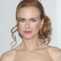 Nicole Kidman is csúnyán belenézett a vakuba