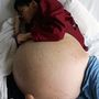 A kínai Csen Huanhsziang hasában közel 50 kilós daganat nőtt, de évekig nem ment orvoshoz. Végül egy orvoscsoport felajánlotta hogy ingyen megműtik